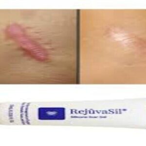 Kem trị sẹo lồi Rejuvasil 10g